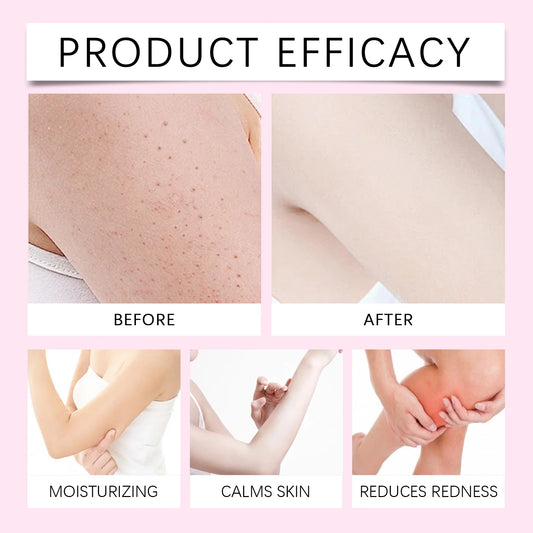 Hair Removal Care Essential Oil Gently Cares For The Skin Cleanses Hair Removal Moisturizes&Moisturizes Daily Care Essential Oil