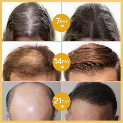 Ginger Hair Growth Essential Oil Anti-loss Hair Treatment Hair Regrowth Oil Fast Hair Promoting Regeneration Hair Care Women Men
