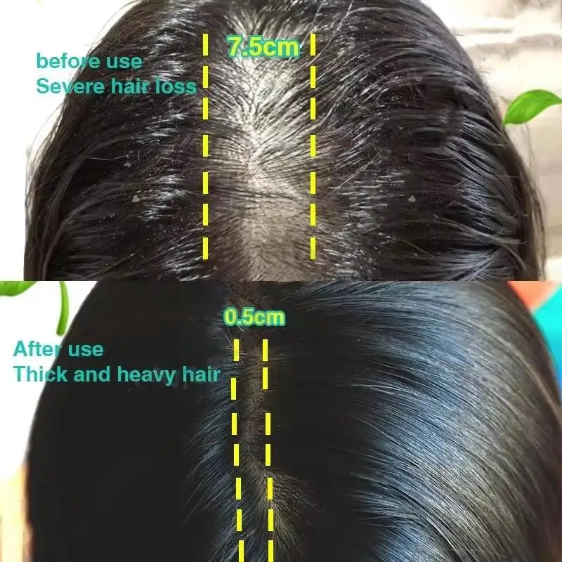 Rosemary Hair Growth Oil Anti Hairs Loss Treatment Mint Hair Strengthening Oil Nourishing Roots Regrowth Hair For Men Women 50ml