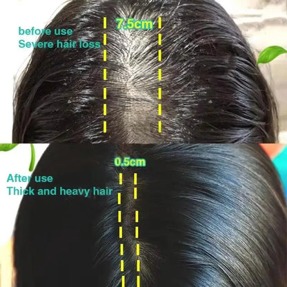 Rosemary Hair Growth Oil Anti Hairs Loss Treatment Mint Hair Strengthening Oil Nourishing Roots Regrowth Hair For Men Women 50ml