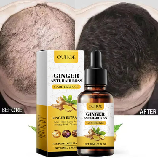 Ginger Hair Growth Essential Oil Anti-loss Hair Treatment Hair Regrowth Oil Fast Hair Promoting Regeneration Hair Care Women Men