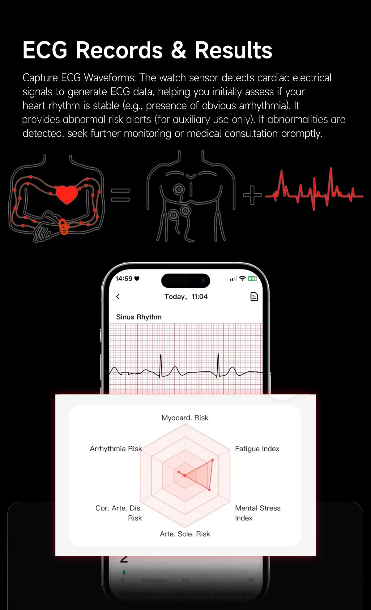 LIGE 2026 ECG+PPG Nursing Grade Smart Bracelet HRV Body Fat BMI Blood Pressure Body Temperature Men Women Health Sports Watches