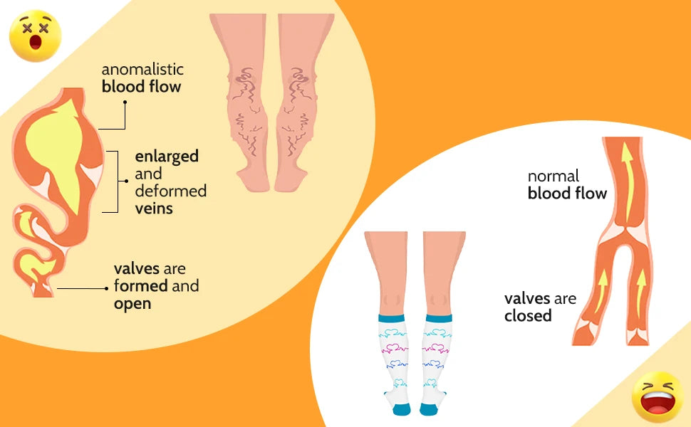 1Pair Plus Size 2XL-7XL New Compression Socks Unisex Wide Calf Knee High Compression Stockings Support for Circulation Nurses