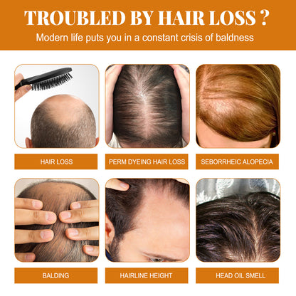 EELHOE Anti Hair Thinning Shampoo Prevent Hair Loss Regeneration Smoothing Frizzy Treatment Anti-Dandruff Oil Control Shampoo