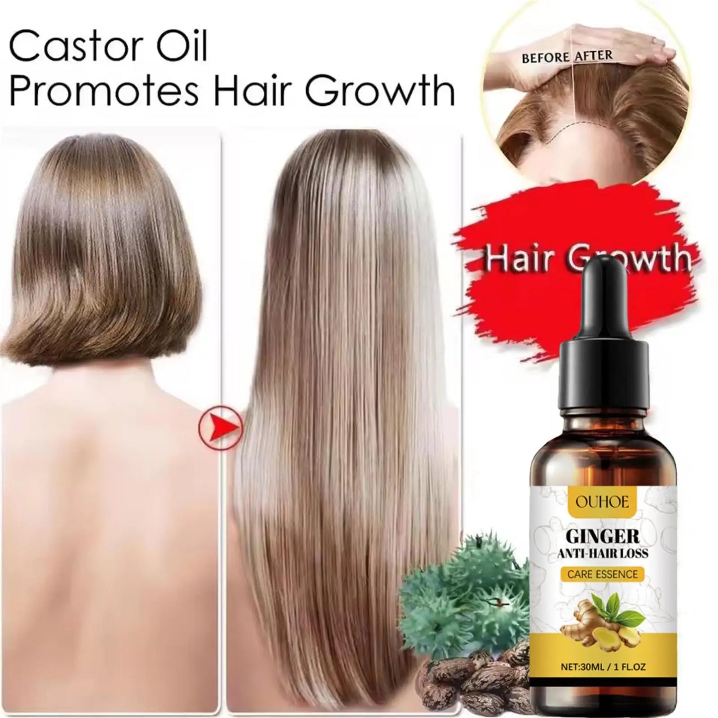 Ginger Hair Growth Essential Oil Anti-loss Hair Treatment Hair Regrowth Oil Fast Hair Promoting Regeneration Hair Care Women Men
