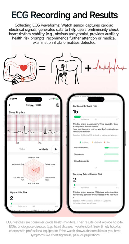 2026 Original Women Health Accurate Diagnosis Smart Watch ECG+HRV BP Blood Oxygen Uric Acid Heart Rate Bluetooth Call Smartwatch