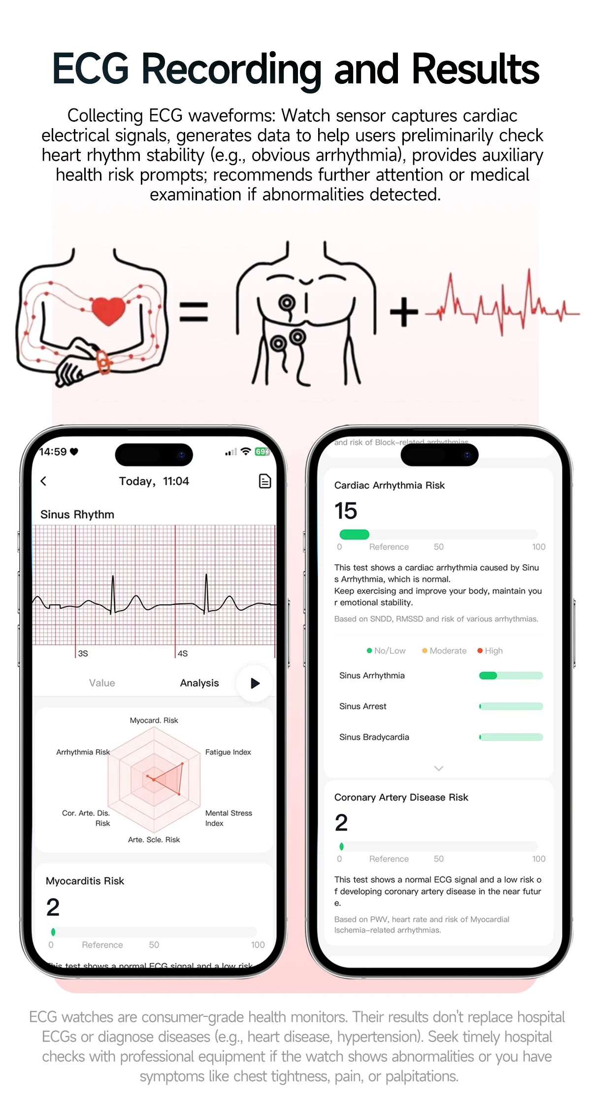 New Precise Health Care Smart Watch ECG+HRV Uric Acid Blood Lipids Emotional Perception Bluetooth Call Smartwatchs For Men Women