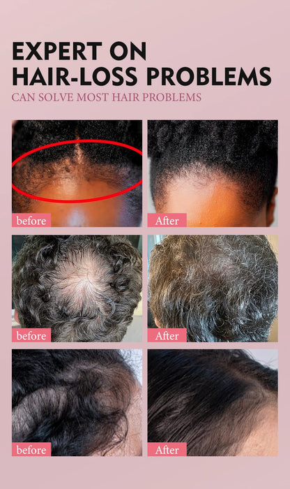 Hair Growth Essential Oil Hair Batana Faster Strengthening Oil Hair Africa Crazy Cream Repair Scalp Anti-hair loss Scalp Care