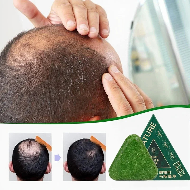 Arborvitae Leaf Shampoo Bar Usman Herbs Strengthen Hair Thicken Hair  Oil Control Anti-dandruff Oriental Natural Shampoo Bar