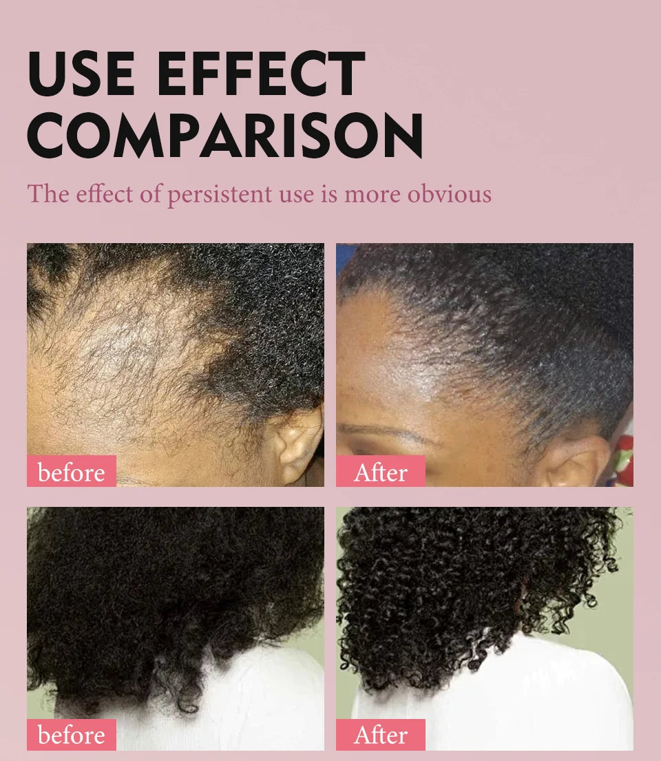 Hair Growth Essential Oil Hair Batana Faster Strengthening Oil Hair Africa Crazy Cream Repair Scalp Anti-hair loss Scalp Care