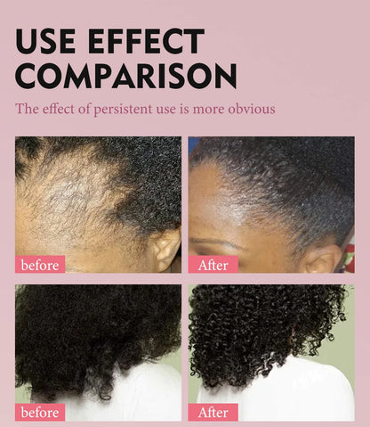 Hair Growth Essential Oil Hair Batana Faster Strengthening Oil Hair Africa Crazy Cream Repair Scalp Anti-hair loss Scalp Care