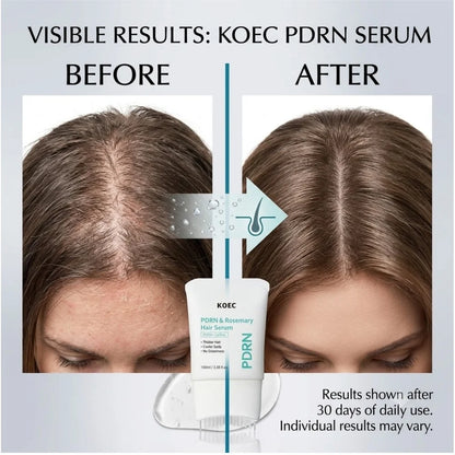 Scalp Massage Serum with Silicone Applicator Anti Hair Loss Care Lotion PDRN Rosemary Tea Tree Oil Refreshing Hair Root Essence