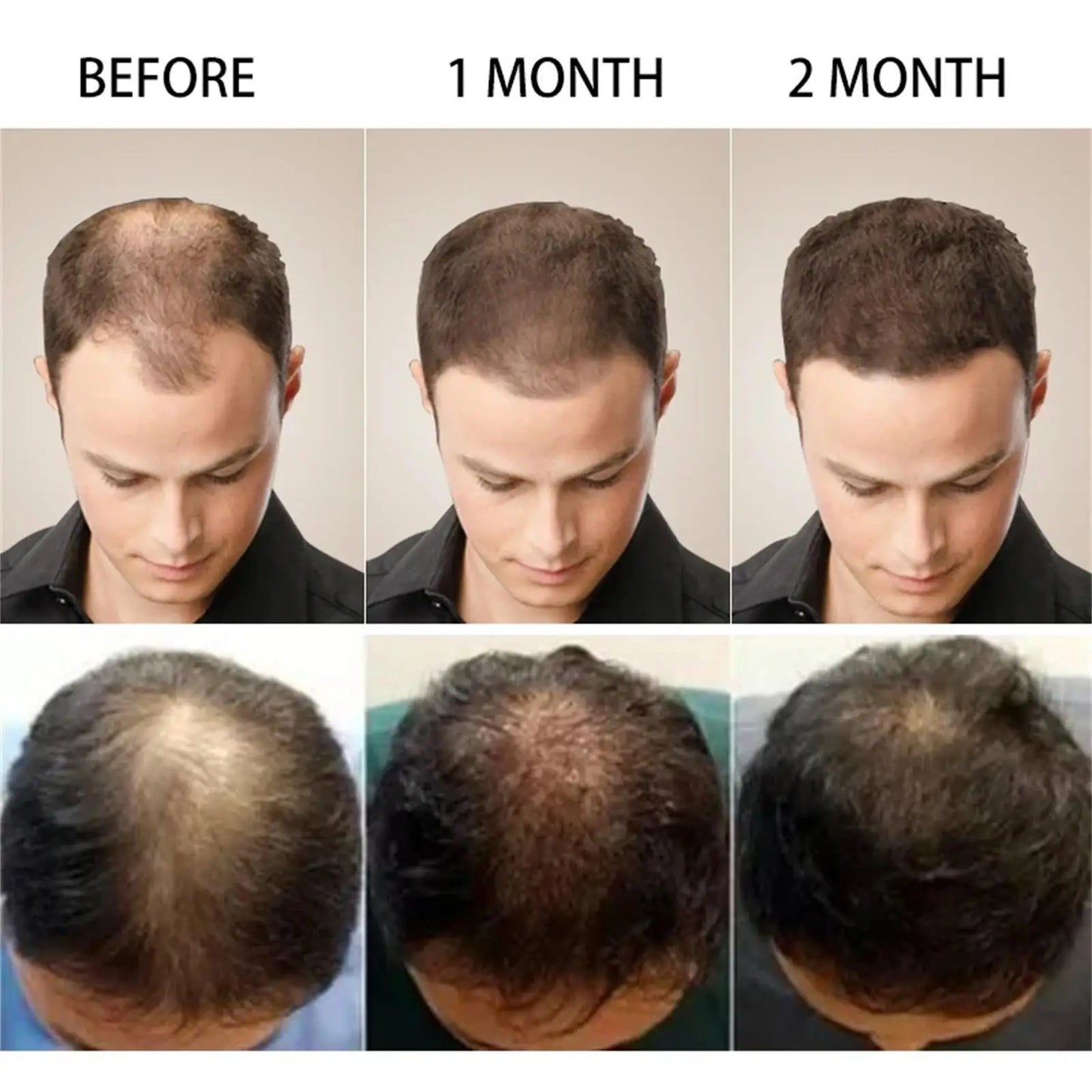 Ginger Hair Growth Essential Oil Anti-loss Hair Treatment Hair Regrowth Oil Fast Hair Promoting Regeneration Hair Care Women Men