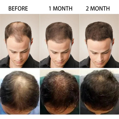 Ginger Hair Growth Essential Oil Anti-loss Hair Treatment Hair Regrowth Oil Fast Hair Promoting Regeneration Hair Care Women Men