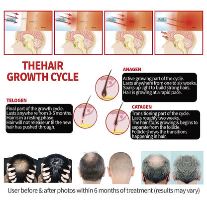 Hair Growth Cap Reduces Oiliness Strengthens Hair Roots Penetrates Deep Into Hair Follicles Relieves Fatigue Anti-Hair Loss Hat