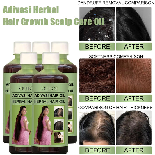100ml Hair Growth Essential Oil India Original Rosemary Damaged Hydrate Nourishing Scalp Reduce Dandruff Herbal Hair Care Serum