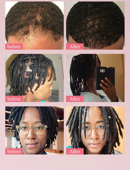 Hair Growth Essential Oil Hair Batana Faster Strengthening Oil Hair Africa Crazy Cream Repair Scalp Anti-hair loss Scalp Care
