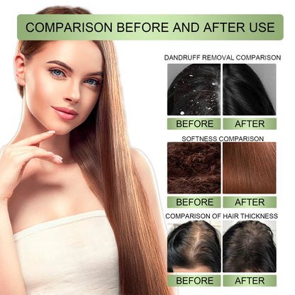 100ml Hair Growth Essential Oil India Original Rosemary Damaged Hydrate Nourishing Scalp Reduce Dandruff Herbal Hair Care Serum