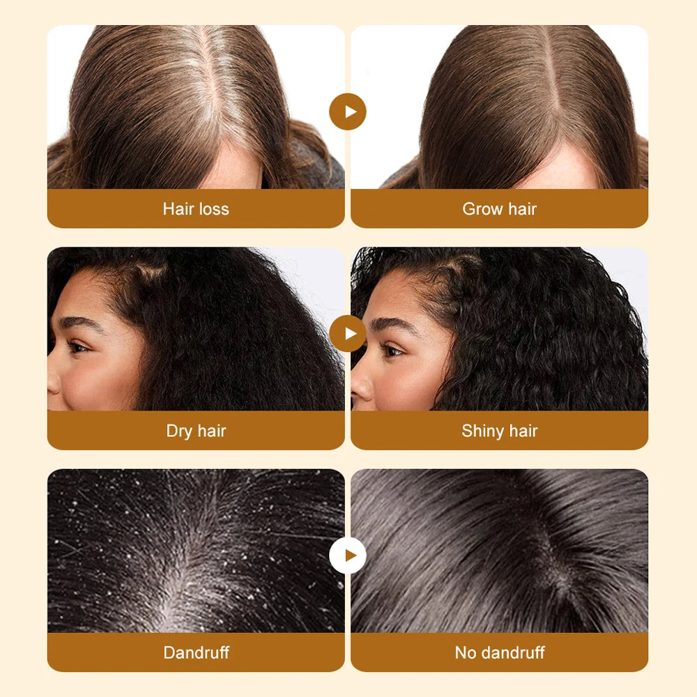 Natural Batana Oil For Hair Growth Anti-Hair Loss Strengthen Roots Repair Damaged Dry Hair Care Essence Oil Eliminate Split Ends