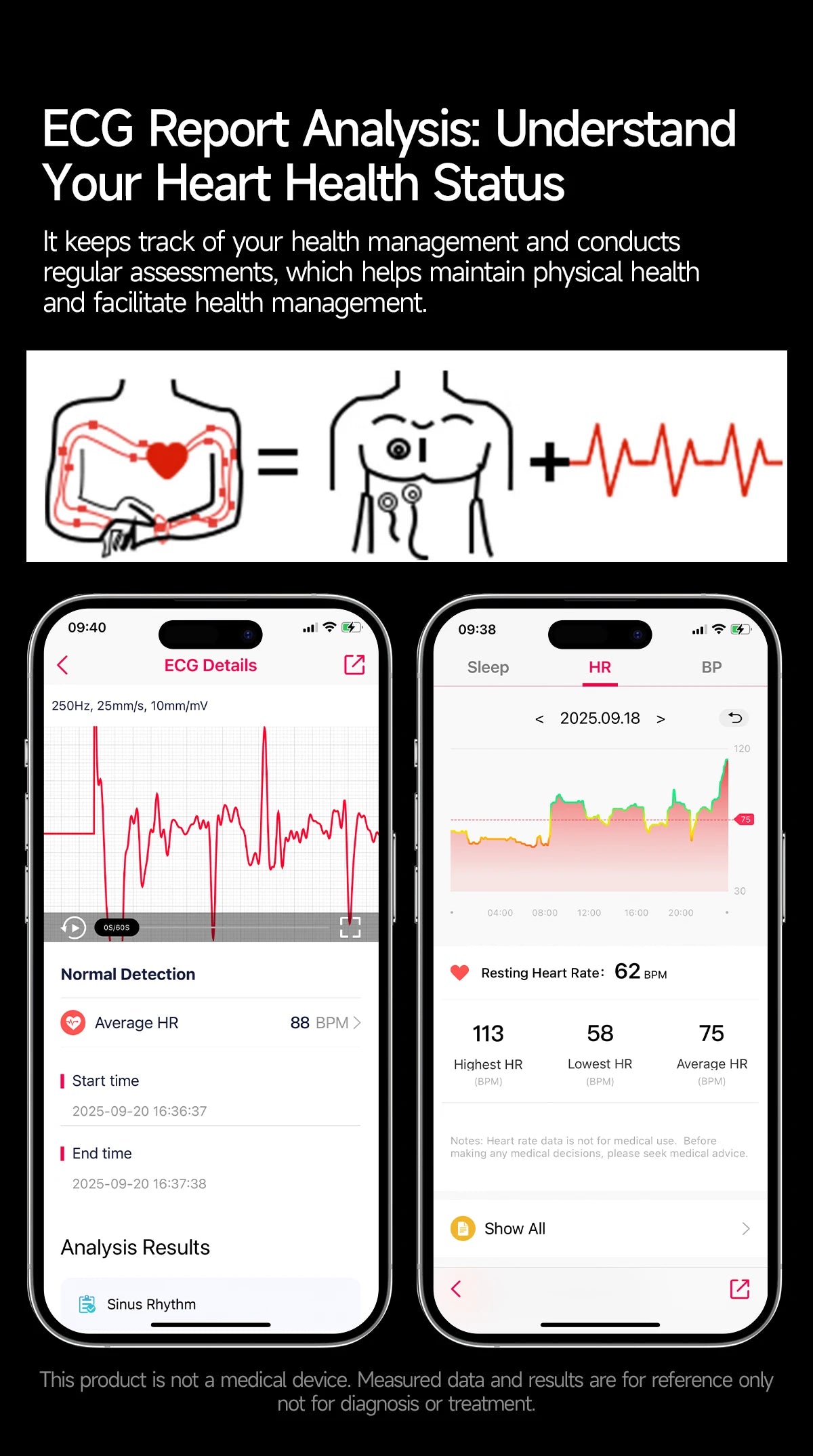 2026 New Health Sport ECG AI Diagnosis Smart Watches Men Heart Rate Blood Pressure IP68 Waterproof Smartwatches For Men Women