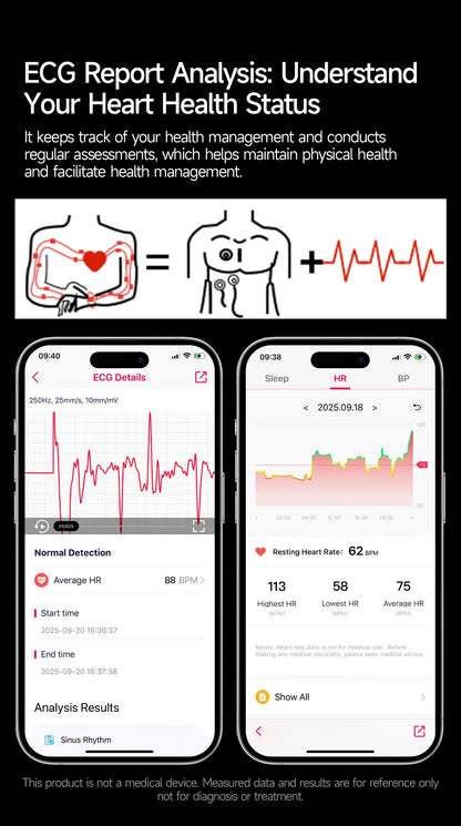 2026 New Health Sport ECG AI Diagnosis Smart Watches Men Heart Rate Blood Pressure IP68 Waterproof Smartwatches For Men Women