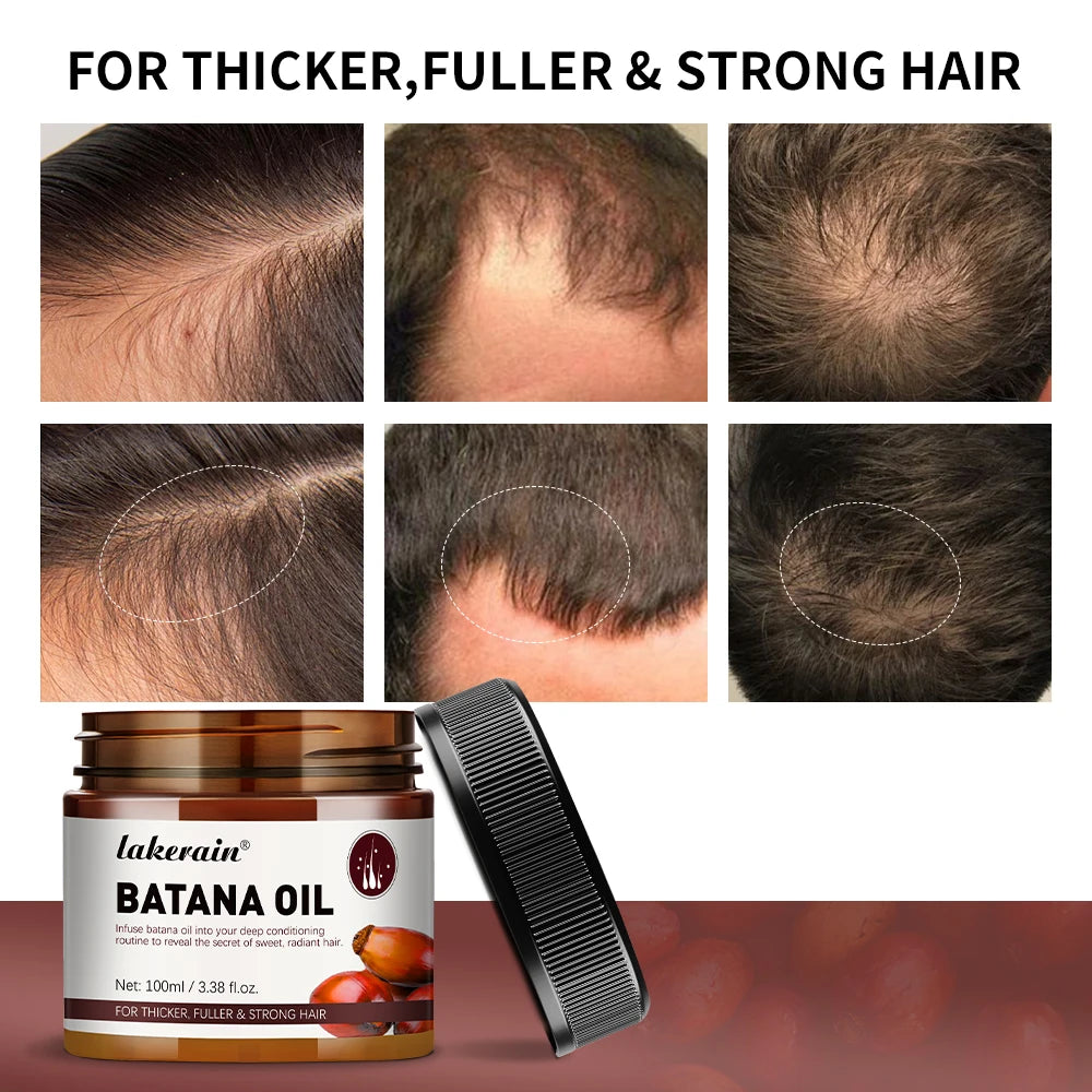 Hair Growth Batana Oil Unrefined Raw for Enhance Efficacy for Thicker Strength Moisturize the scalp Add moisture and nutrition
