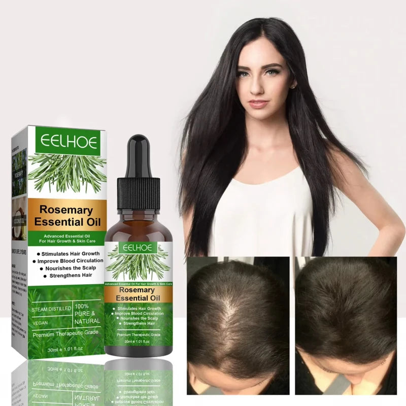 Rosemary Hair Growth Essential Oil 30ml Organic Scalp Treatment Strengthening Anti Hair Loss Nourish Shiny Beauty Women Men Care