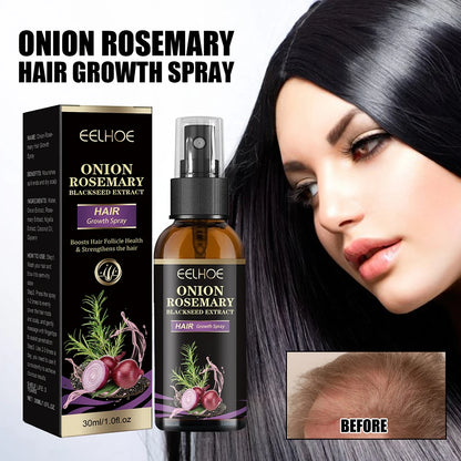 30ml Onion Rosemary Hair Growth Serum Powered With Black Seed-Oil Controls Loss Promotes Growth Shine Hair Softening Spray