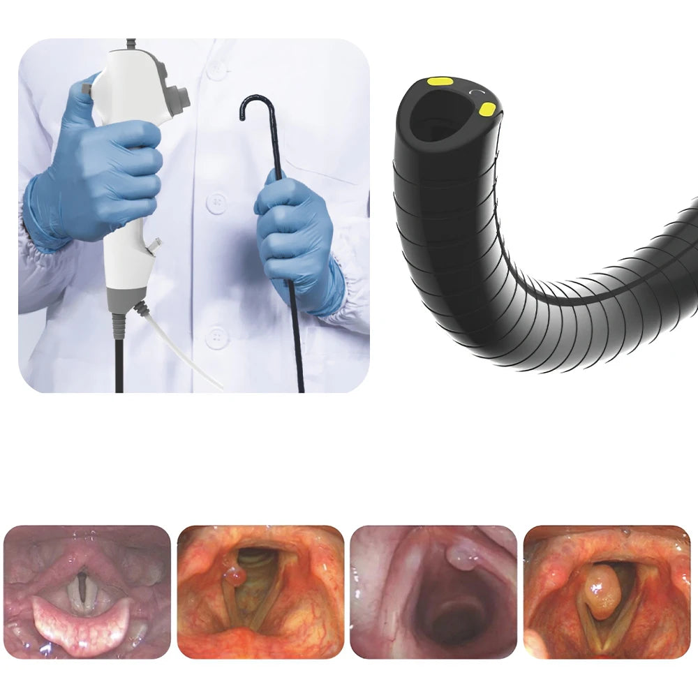 Sinohero Veterinary Endoscope Bronchoscope Nasopharyngoscope 3.8mm Handheld Flexible Endoscopy for Animals