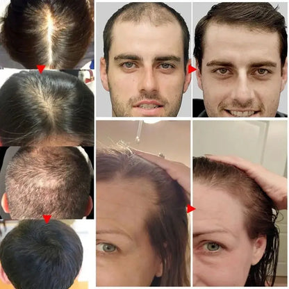 Ginger Hair Growth Essential Oil Anti-loss Hair Treatment Hair Regrowth Oil Fast Hair Promoting Regeneration Hair Care Women Men