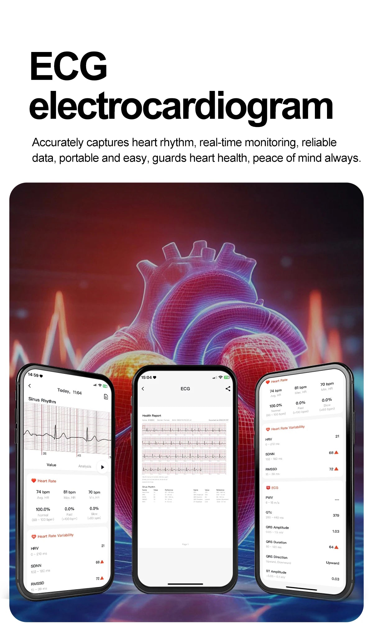 2026 New Non-Invasive Laser Treatment Three High Smart Watch Man ECG Heart Test Blood Fat Uric Acid Smart Watch For Android IOS