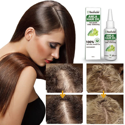 Ayurvedic Original India Adivasi Amla Hair Oil  Anti Hair Loss Scalp Treatment Damaged Hair Repair Growing 50ml