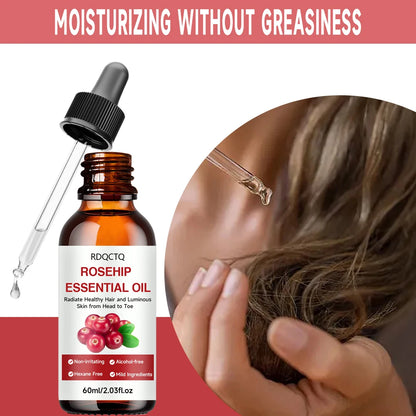 Rose Hip Oil for Hair & Skin - Pure Natural Moisturizing Essential Oil, Alcohol-Free, Nourishing Care for Healthy Look