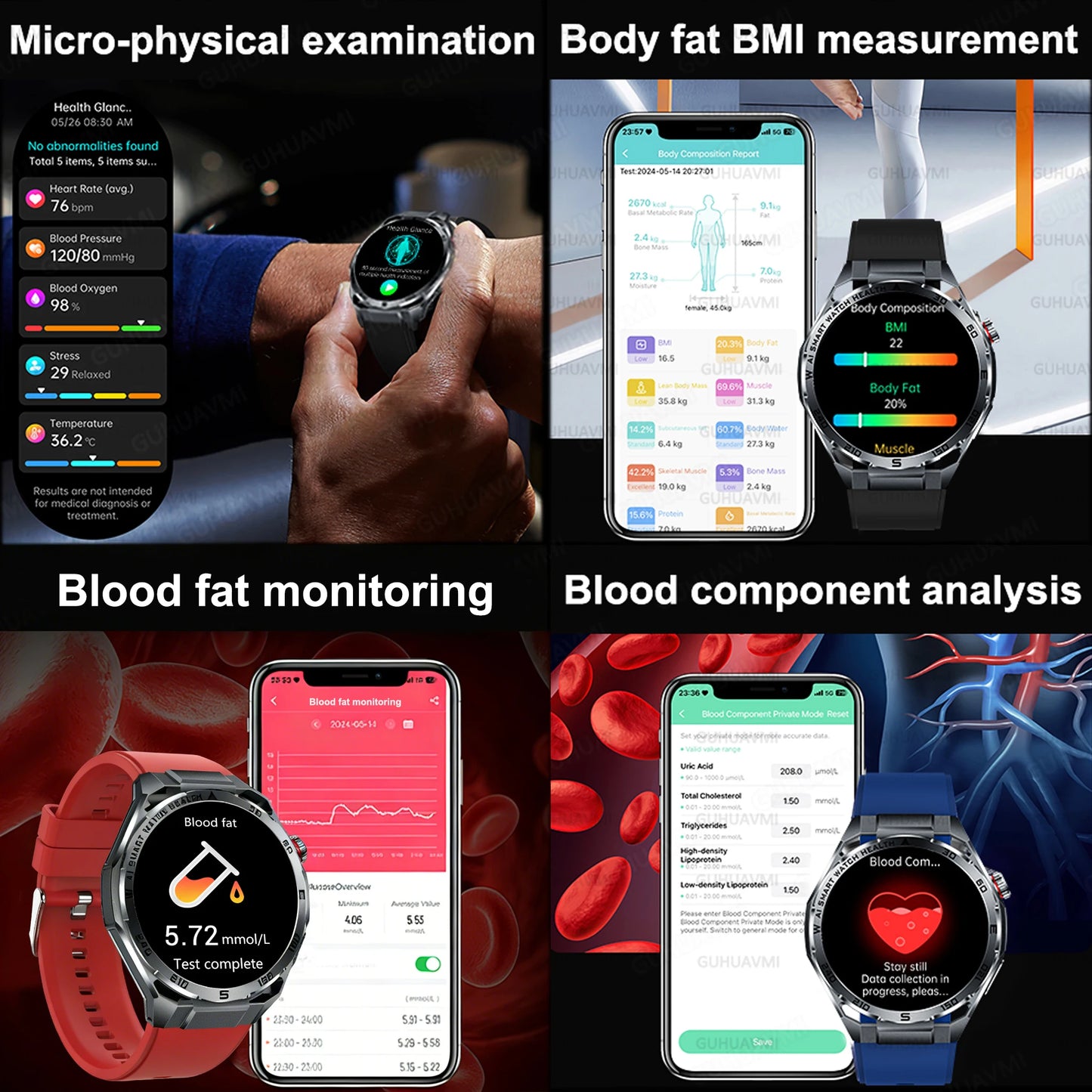 2026 New ECG+PPG Body Fat Analysis Health Smart Watch Uric Acid BP Blood Oxygen Bluetooth call Sports Smart Watch For Men Women