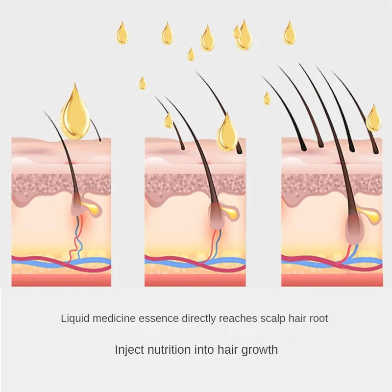New Scalp Applicator Liquid Comb for Hair Scalp Treatment Essential Oil Liquid Guiding Massager Comb Hair Growth Serum Oil Apply