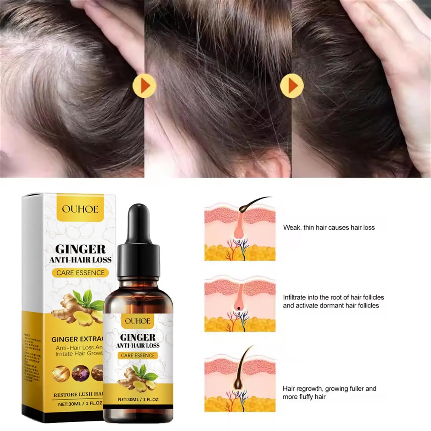 Ginger Hair Growth Essential Oil Anti-loss Hair Treatment Hair Regrowth Oil Fast Hair Promoting Regeneration Hair Care Women Men