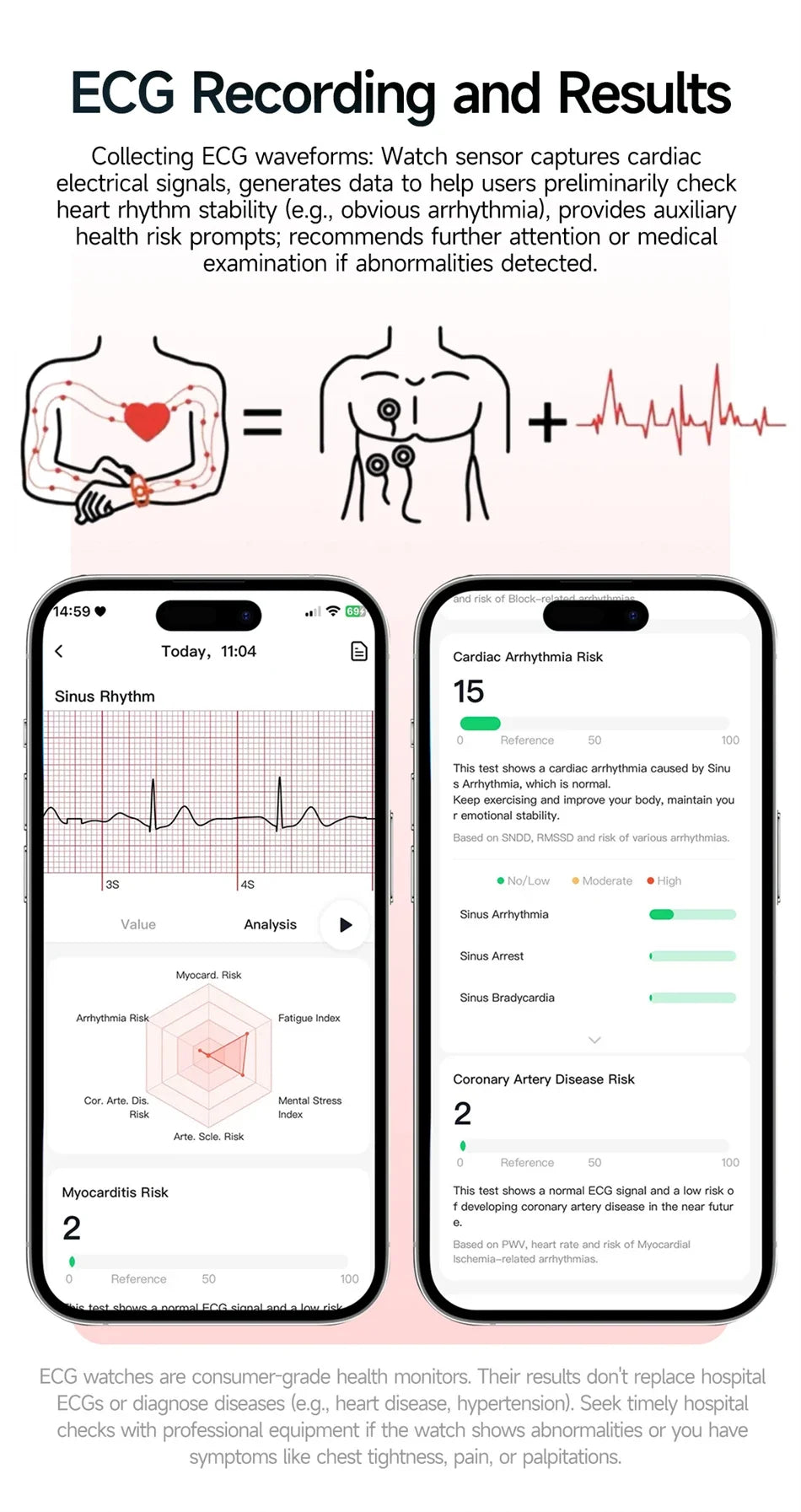 2026 New Professional-Grade Health Smart Watch Men ECG BP HR Uric Acid Lipid BMI Body Analysis Bluetooth Call Smartwatch Women