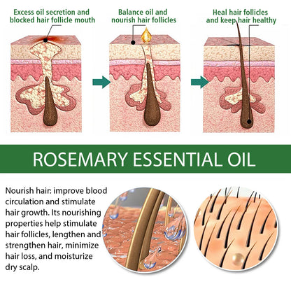 Rosemary Essential Oil 60ml Hair Growth Serum Scalp Treatment Skin Care Anti Aging Vitamin E Enriched for Thicker Hair Glowing