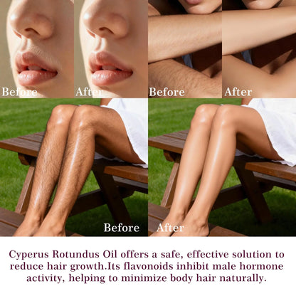 Cyperus Rotundus Oil Roll On, Natural Cyprus Cypress Rotundus Oil for Hair Removal, Reduces Unwanted Hair Growth, Soothes Skin
