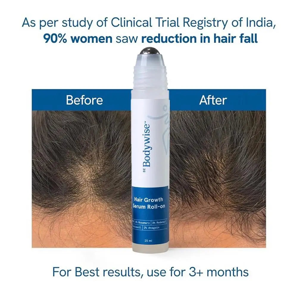25ml Hair Growth Essence Oil for Hair Care, Scalp Nourishment & Frizz Control 3% Rosemary Hair Serum