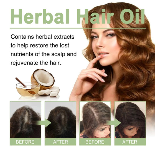 100ml Hair Growth Essential Oil India Original Rosemary Damaged Hydrate Nourishing Scalp Reduce Dandruff Herbal Hair Care Serum