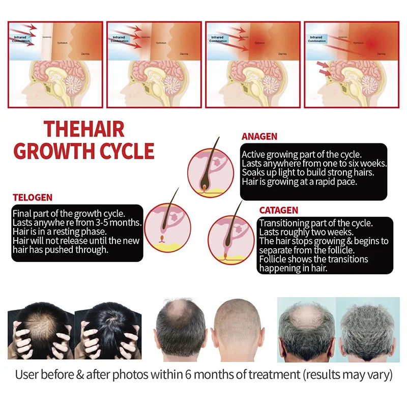 Hair Growth Cap Reduces Oiliness Strengthens Hair Roots Penetrates Deep Into Hair Follicles Relieves Fatigue Anti-Hair Loss Hat